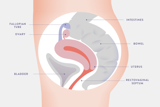 Endometrial tissue implanted in the peritoneum has a varied